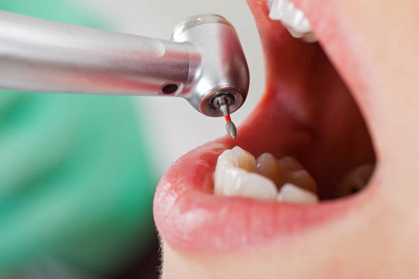 Best Dentist for Dental Trauma  in Lake Station, IN